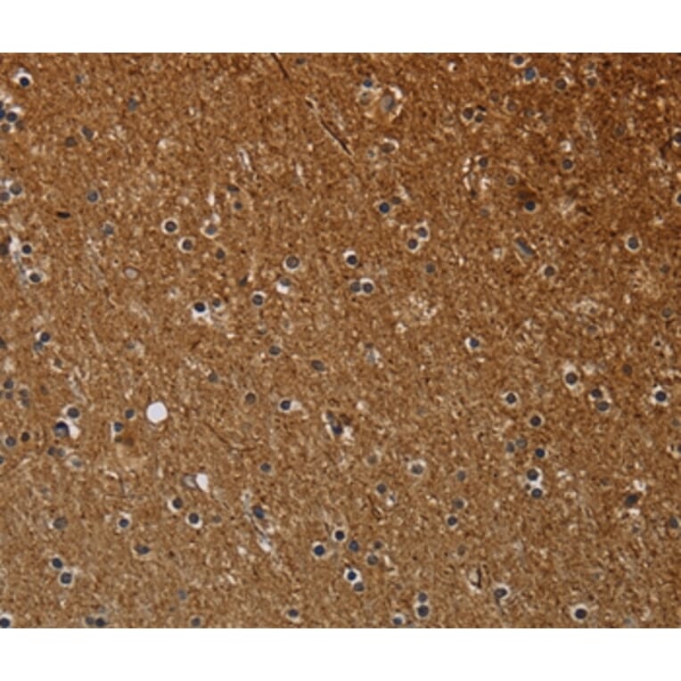 Immunohistochemistry - NCKAP1 Antibody from Signalway Antibody (37754) - Antibodies.com