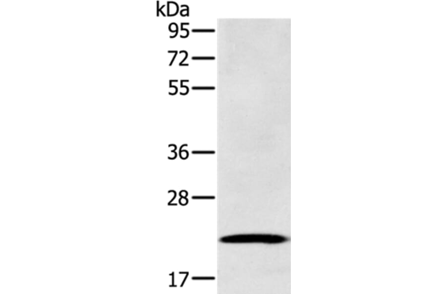 RAB39B Antibody from Signalway Antibody (37762) - Antibodies.com