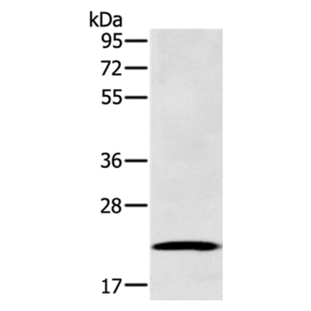 RAB39B Antibody from Signalway Antibody (37762) - Antibodies.com