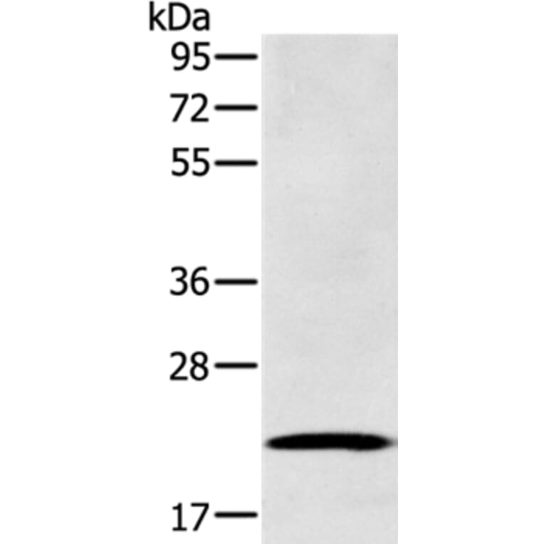 RAB39B Antibody from Signalway Antibody (37762) - Antibodies.com