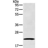 RAB39B Antibody from Signalway Antibody (37762) - Antibodies.com