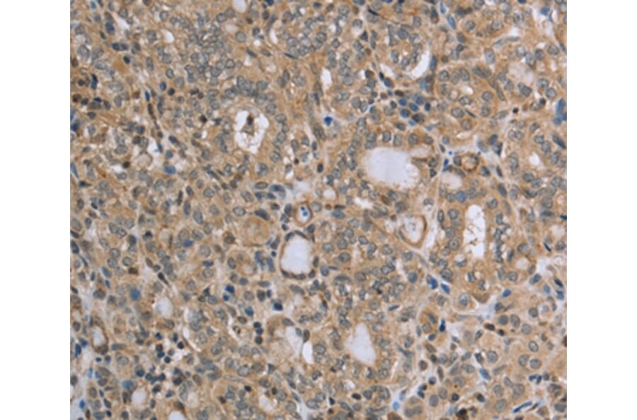 Immunohistochemistry - RAB39B Antibody from Signalway Antibody (37762) - Antibodies.com