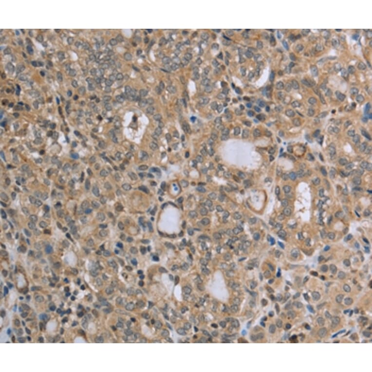 Immunohistochemistry - RAB39B Antibody from Signalway Antibody (37762) - Antibodies.com