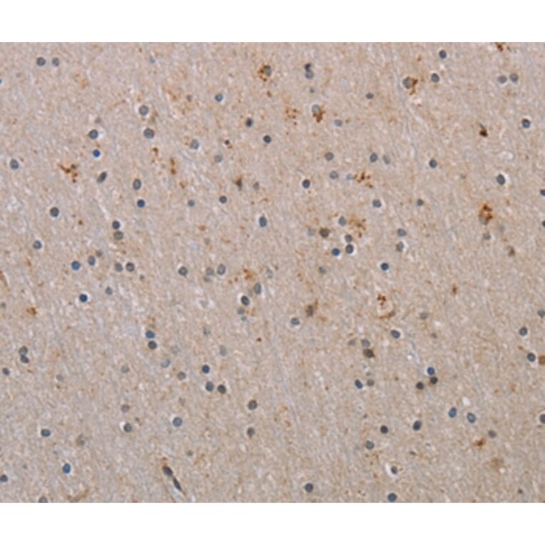 Immunohistochemistry - RAB39B Antibody from Signalway Antibody (37762) - Antibodies.com