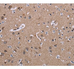 Immunohistochemistry - SH2D3A Antibody from Signalway Antibody (37779) - Antibodies.com