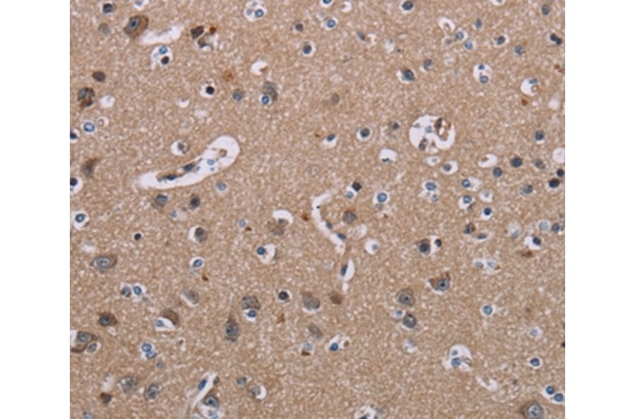 Immunohistochemistry - SH2D3A Antibody from Signalway Antibody (37779) - Antibodies.com
