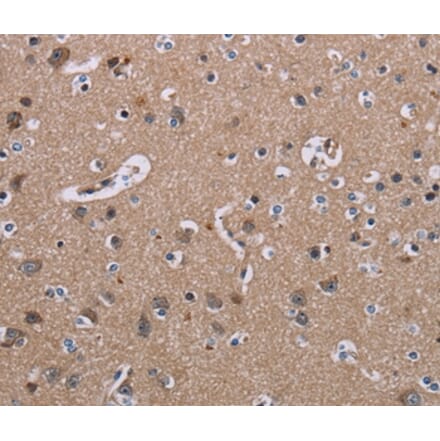 Immunohistochemistry - SH2D3A Antibody from Signalway Antibody (37779) - Antibodies.com