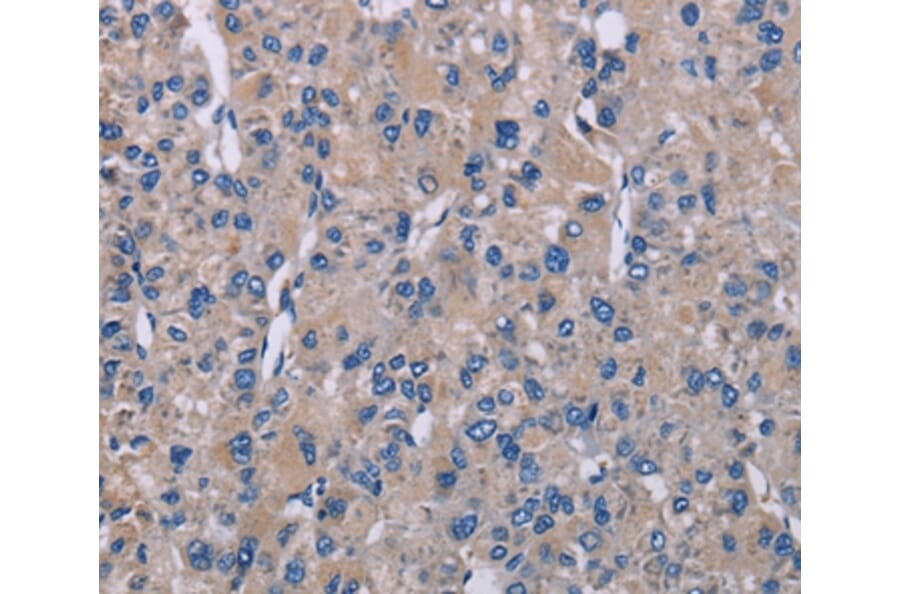 Immunohistochemistry - SH2D3A Antibody from Signalway Antibody (37779) - Antibodies.com