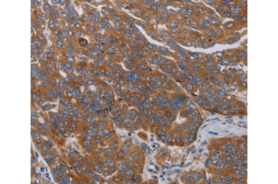 Immunohistochemistry - PARP10 Antibody from Signalway Antibody (37799) - Antibodies.com