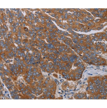 Immunohistochemistry - PARP10 Antibody from Signalway Antibody (37799) - Antibodies.com