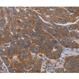 Immunohistochemistry - PARP10 Antibody from Signalway Antibody (37799) - Antibodies.com