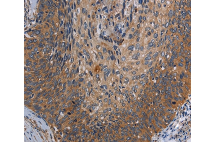 Immunohistochemistry - PARP10 Antibody from Signalway Antibody (37799) - Antibodies.com