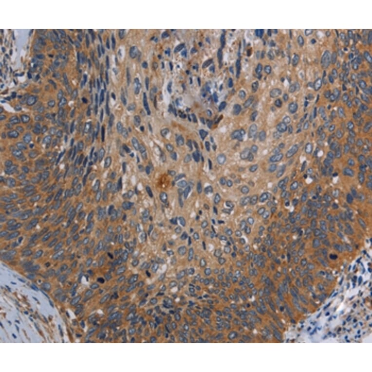 Immunohistochemistry - PARP10 Antibody from Signalway Antibody (37799) - Antibodies.com