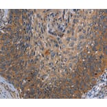 Immunohistochemistry - PARP10 Antibody from Signalway Antibody (37799) - Antibodies.com