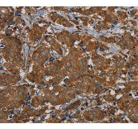Immunohistochemistry - PIK3CD Antibody from Signalway Antibody (37826) - Antibodies.com