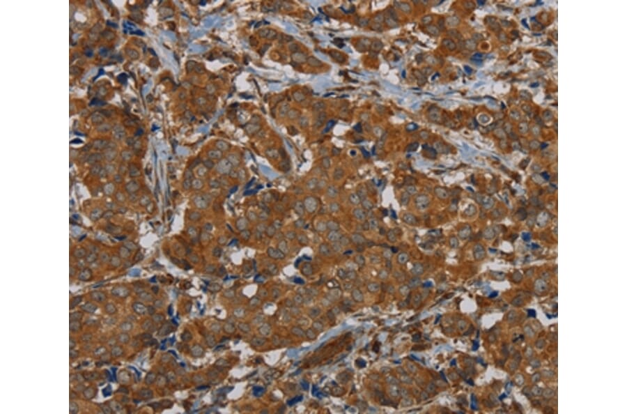 Immunohistochemistry - PIK3CD Antibody from Signalway Antibody (37826) - Antibodies.com