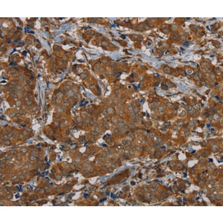 Immunohistochemistry - PIK3CD Antibody from Signalway Antibody (37826) - Antibodies.com