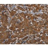 Immunohistochemistry - PIK3CD Antibody from Signalway Antibody (37826) - Antibodies.com