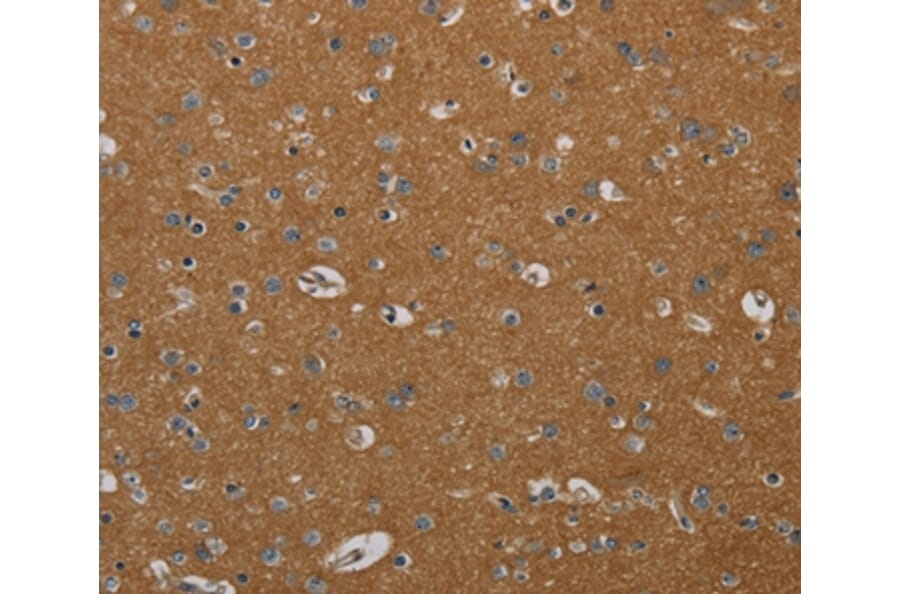 Immunohistochemistry - PIK3CD Antibody from Signalway Antibody (37826) - Antibodies.com