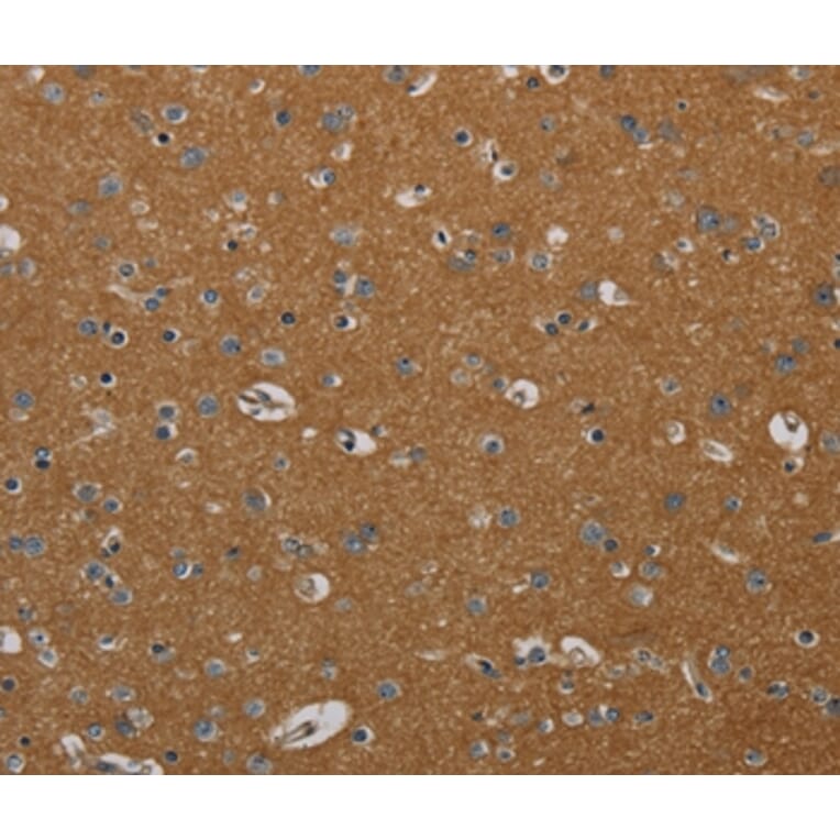 Immunohistochemistry - PIK3CD Antibody from Signalway Antibody (37826) - Antibodies.com