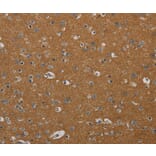 Immunohistochemistry - PIK3CD Antibody from Signalway Antibody (37826) - Antibodies.com