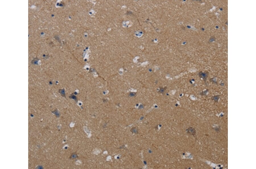 Immunohistochemistry - PIK3CG Antibody from Signalway Antibody (37827) - Antibodies.com