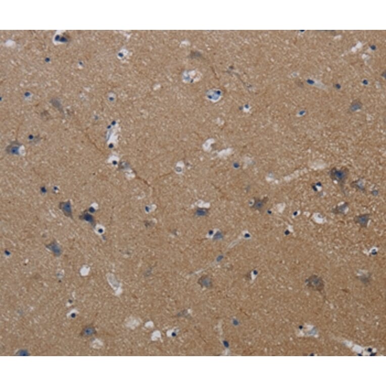 Immunohistochemistry - PIK3CG Antibody from Signalway Antibody (37827) - Antibodies.com
