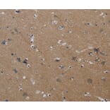 Immunohistochemistry - PIK3CG Antibody from Signalway Antibody (37827) - Antibodies.com