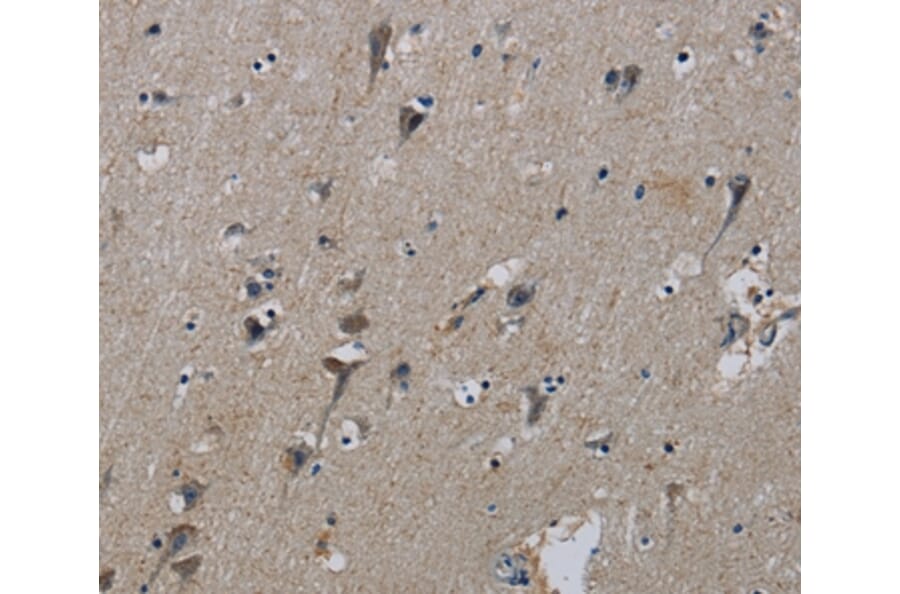 Immunohistochemistry - PIK3CB Antibody from Signalway Antibody (37828) - Antibodies.com