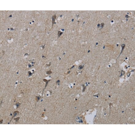 Immunohistochemistry - PIK3CB Antibody from Signalway Antibody (37828) - Antibodies.com