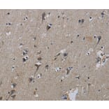 Immunohistochemistry - PIK3CB Antibody from Signalway Antibody (37828) - Antibodies.com