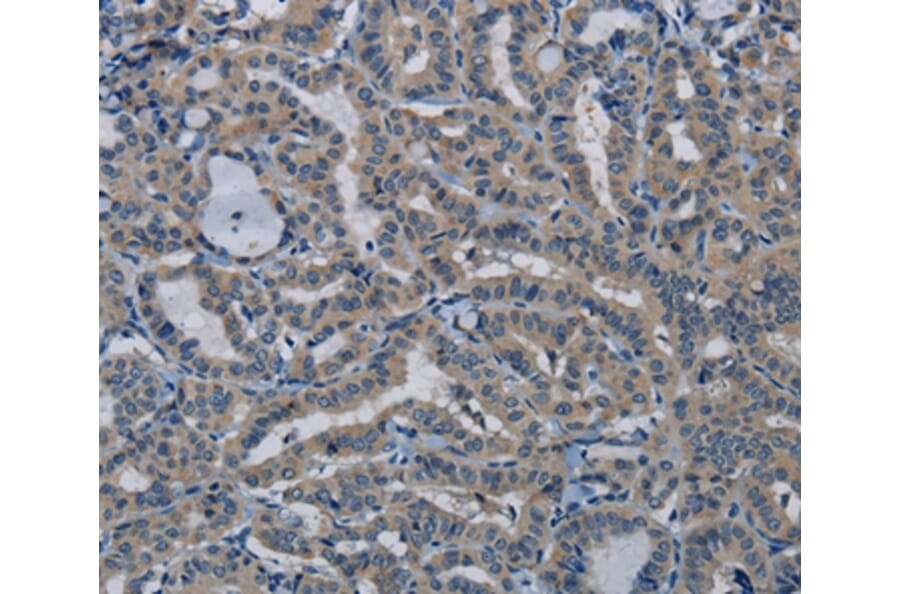 Immunohistochemistry - PIK3CB Antibody from Signalway Antibody (37828) - Antibodies.com