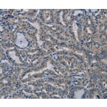 Immunohistochemistry - PIK3CB Antibody from Signalway Antibody (37828) - Antibodies.com