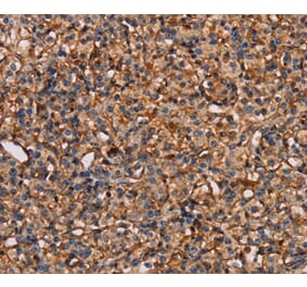 Immunohistochemistry - PLXNA1 Antibody from Signalway Antibody (37833) - Antibodies.com