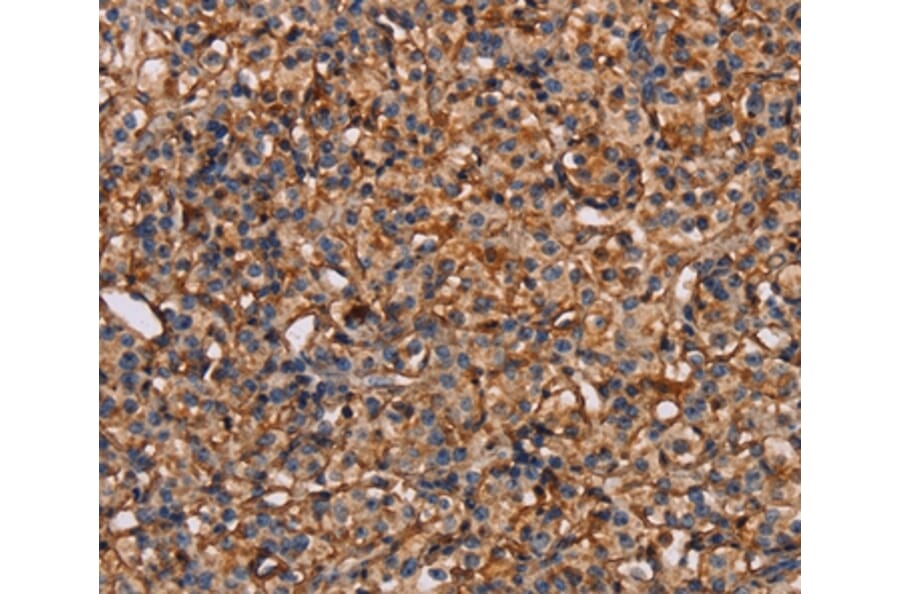 Immunohistochemistry - PLXNA1 Antibody from Signalway Antibody (37833) - Antibodies.com