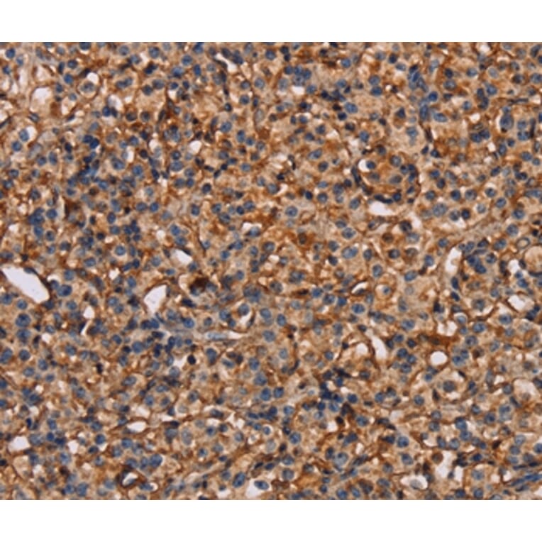 Immunohistochemistry - PLXNA1 Antibody from Signalway Antibody (37833) - Antibodies.com