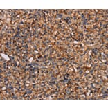 Immunohistochemistry - PLXNA1 Antibody from Signalway Antibody (37833) - Antibodies.com