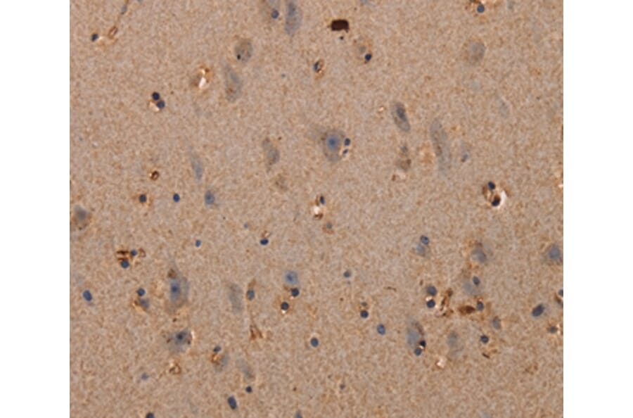 Immunohistochemistry - PLXNA1 Antibody from Signalway Antibody (37833) - Antibodies.com