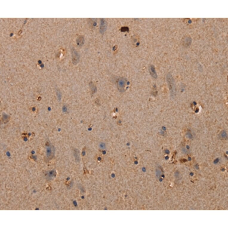 Immunohistochemistry - PLXNA1 Antibody from Signalway Antibody (37833) - Antibodies.com
