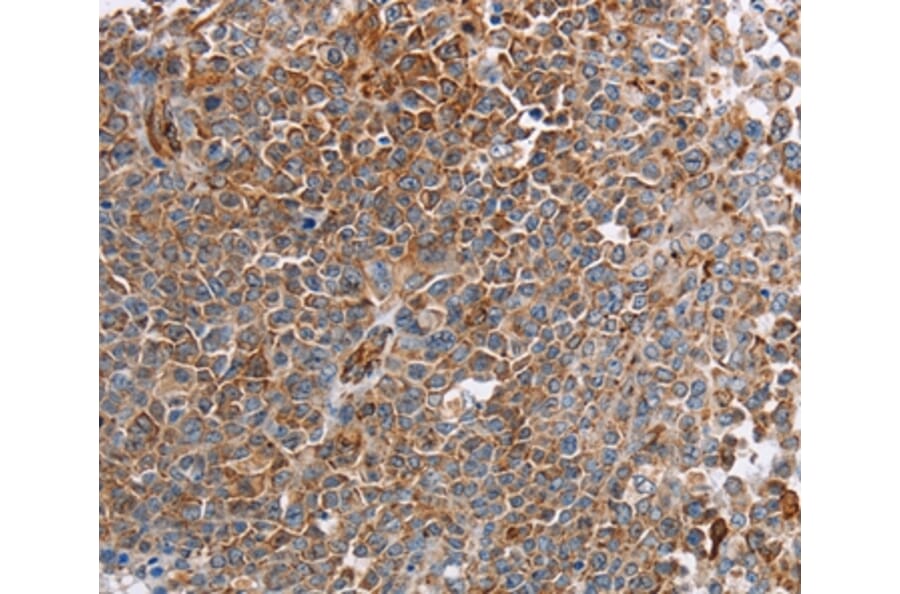 Immunohistochemistry - PLXNA2 Antibody from Signalway Antibody (37834) - Antibodies.com