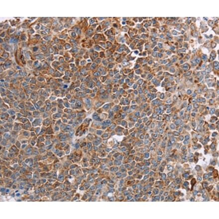 Immunohistochemistry - PLXNA2 Antibody from Signalway Antibody (37834) - Antibodies.com