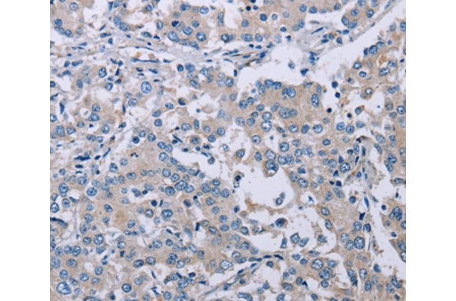 Immunohistochemistry - PLXNA2 Antibody from Signalway Antibody (37834) - Antibodies.com