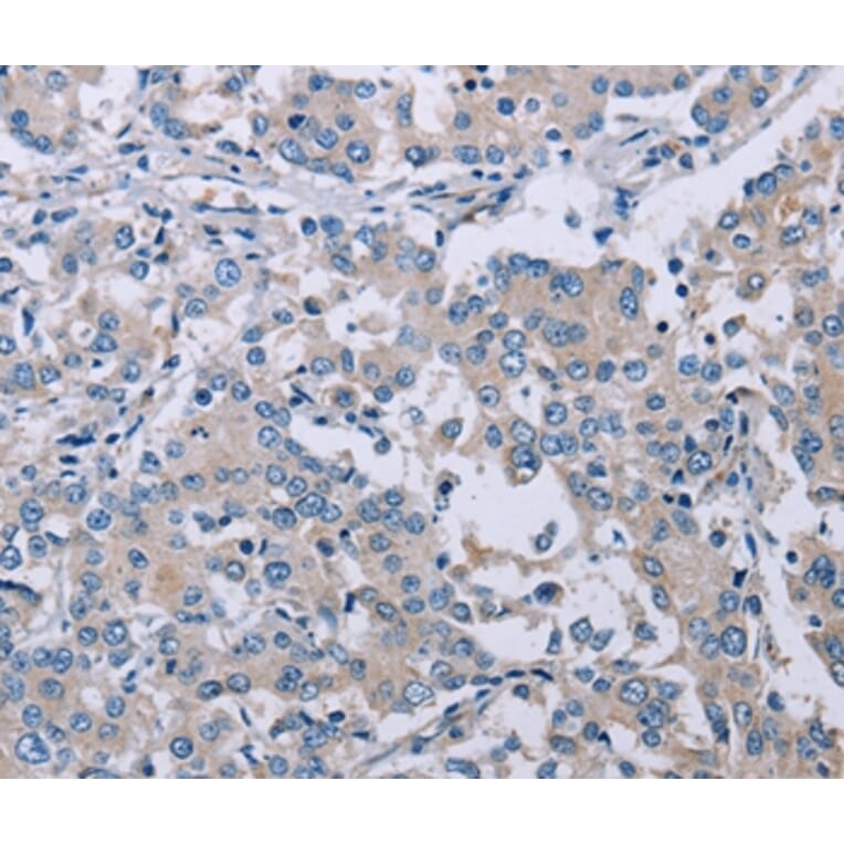 Immunohistochemistry - PLXNA2 Antibody from Signalway Antibody (37834) - Antibodies.com