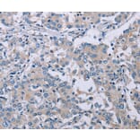 Immunohistochemistry - PLXNA2 Antibody from Signalway Antibody (37834) - Antibodies.com