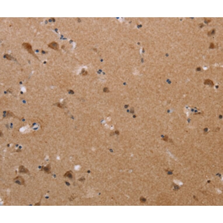 Immunohistochemistry - PLXNA4 Antibody from Signalway Antibody (37835) - Antibodies.com