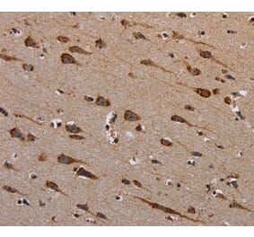 Immunohistochemistry - PLXNB1 Antibody from Signalway Antibody (37836) - Antibodies.com