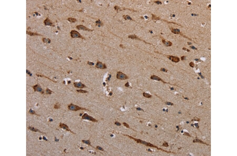 Immunohistochemistry - PLXNB1 Antibody from Signalway Antibody (37836) - Antibodies.com