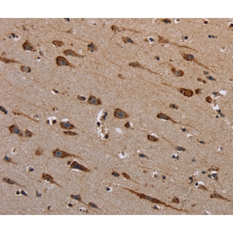 Immunohistochemistry - PLXNB1 Antibody from Signalway Antibody (37836) - Antibodies.com