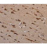 Immunohistochemistry - PLXNB1 Antibody from Signalway Antibody (37836) - Antibodies.com