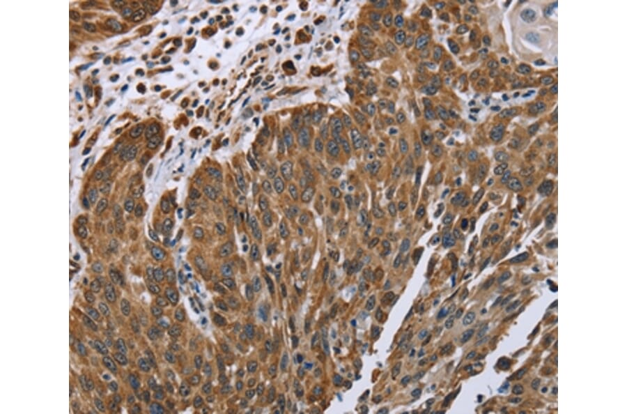 Immunohistochemistry - PLXNB1 Antibody from Signalway Antibody (37836) - Antibodies.com